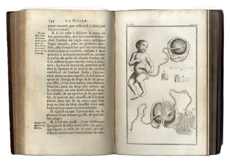 La guide des accoucheurs ou le maistre dans l'art d'accoucher … | Immagine Gallery 3