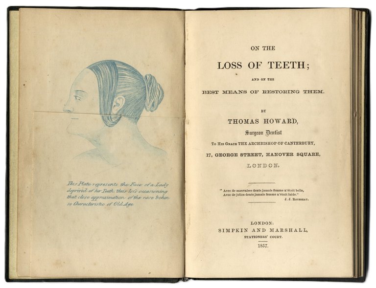 On the loss of teeth and on the best means … | Immagine Gallery 2