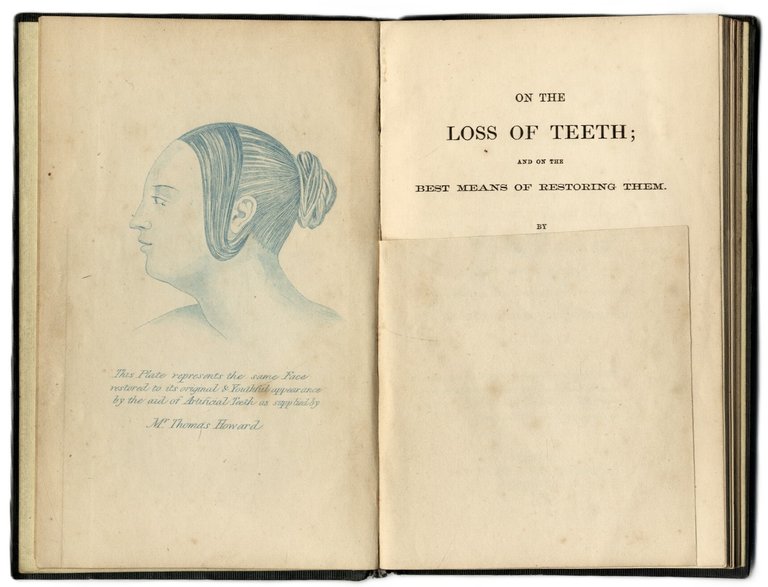 On the loss of teeth and on the best means … | Immagine Gallery 3