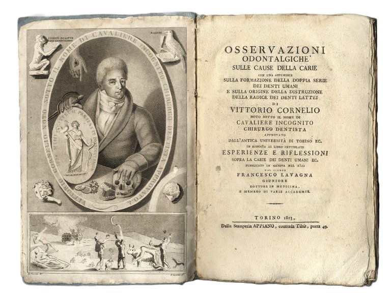 Osservazioni odontalgiche sulle cause della carie. Con una appendice sulla … | Immagine Gallery 3