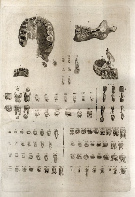 Osservazioni odontalgiche sulle cause della carie. Con una appendice sulla … | Immagine Gallery 4