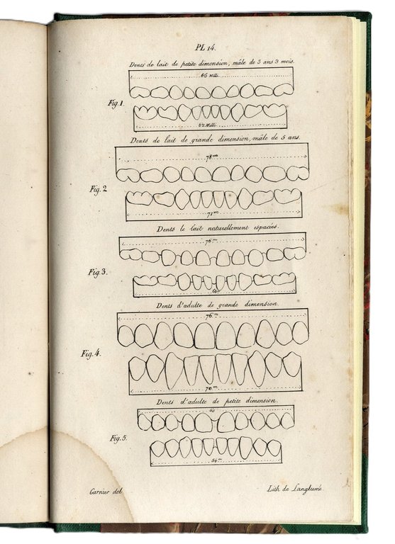 Recherches sur l'art de diriger la Seconde Dentition en g&amp;eacute;n&amp;eacute;ral, … | Immagine Gallery 2