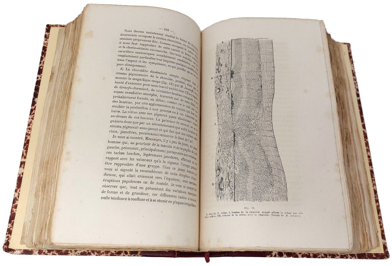 Th&amp;eacute;rapeutique oculaire.&amp;nbsp;Le&amp;ccedil;ons recueillies et redig&amp;eacute;es par le docteur Masselon et …