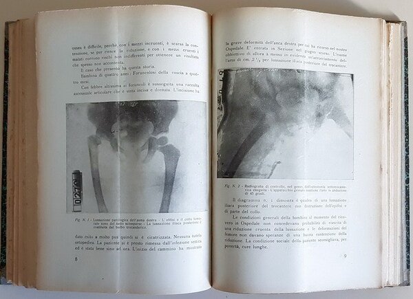 N. 3 annate complete (1935-1936-1937) della rivista medica: ATTI DELL'ACCADEMIA …