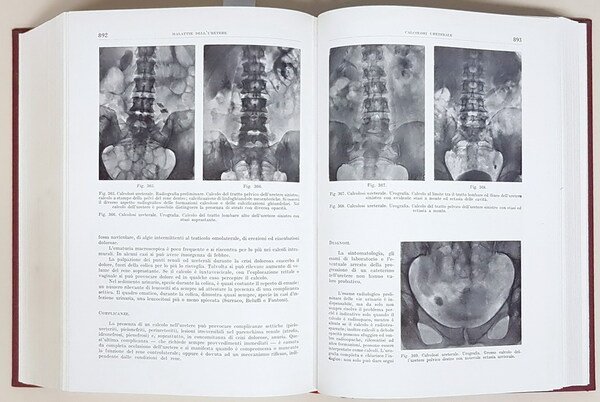 TRATTATO ITALIANO DI MEDICINA INTERNA (parte VII.) - MALATTIE DELL'APPARATO …