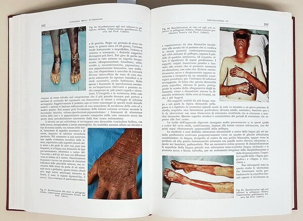 TRATTATO ITALIANO DI MEDICINA INTERNA (parte IX.) - MALATTIE DEL …