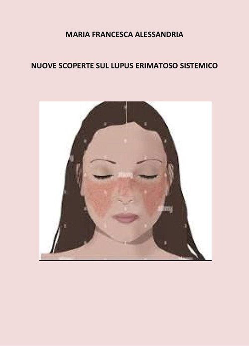 Nuove scoperte sul lupus erimatoso sistemico | Immagine principale