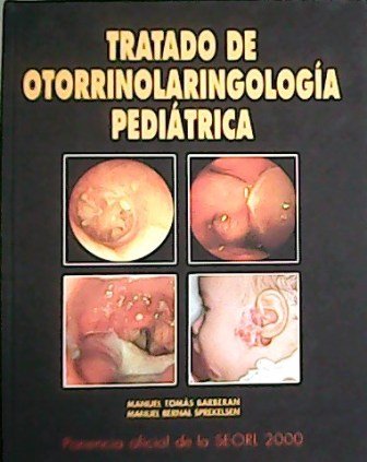Tratado de Otorrinolaringología Pediátrica. Ponencia Oficial de la SEORL 2000.