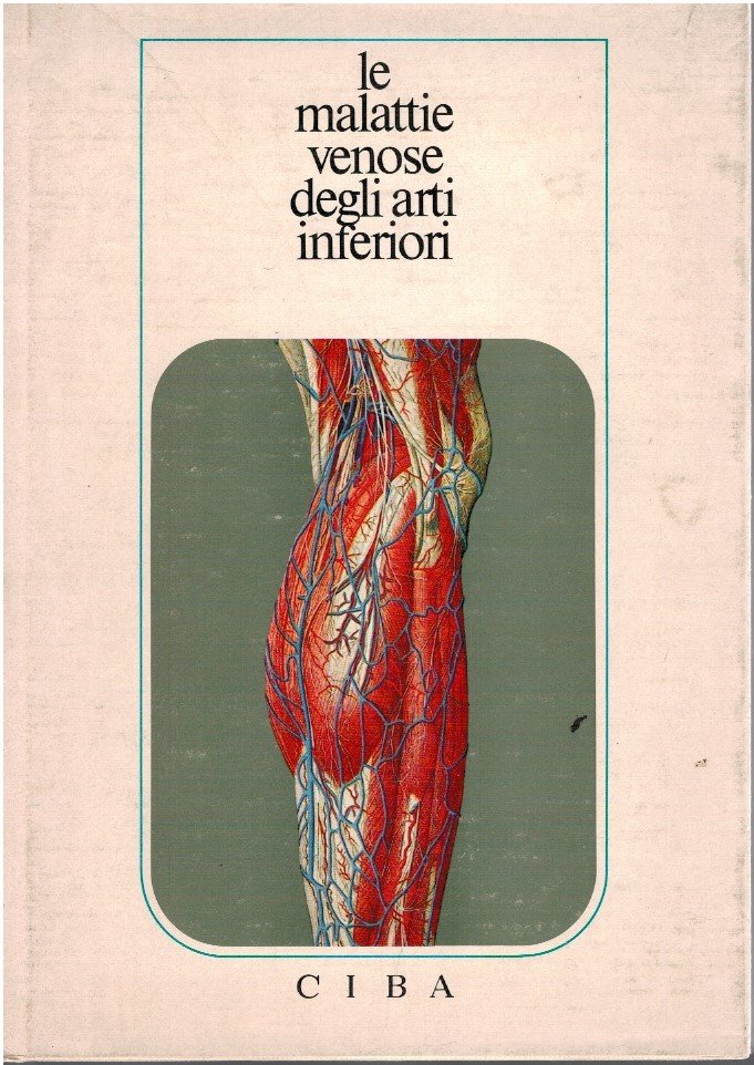 Le malattie venose degli arti inferiori