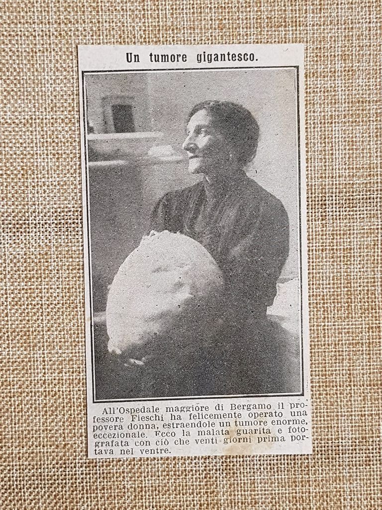 Bergamo nel 1914 Donna e il suo enorme tumore operato …