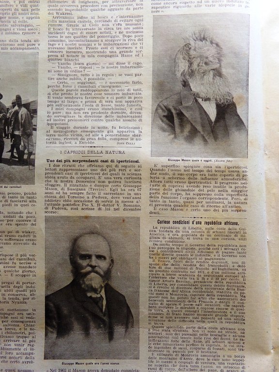 La Domenica del Corriere 5 Marzo 1905 Galleria Sempione Ipertricosi …