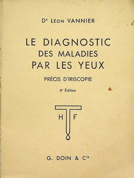 Le diagnostic des maladies par les yeux