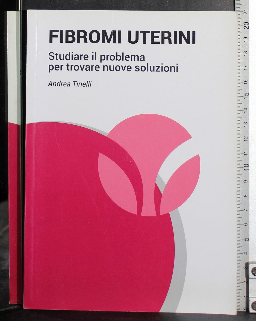 Fibromi uterini | Immagine principale