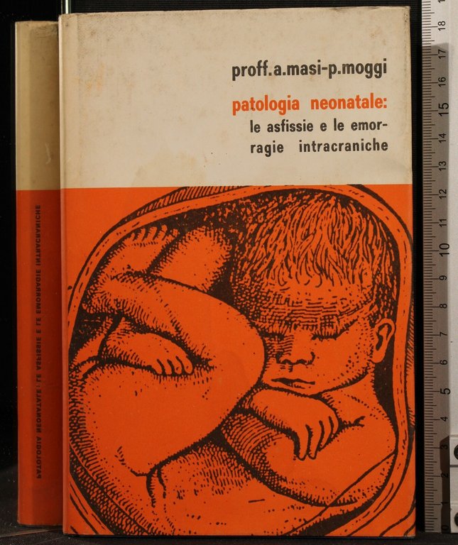 Patologia neonatale: le asfissie e le emorragie intracraniche | Immagine Gallery 2