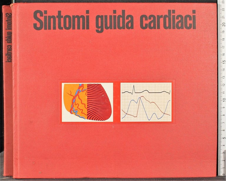 Sintomi guida cardiaci | Immagine Gallery 2