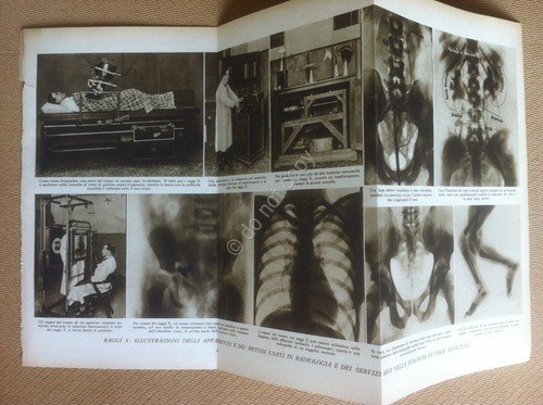 Tavola estratta da Enciclopedia Il Medico in Casa - Raggi …
