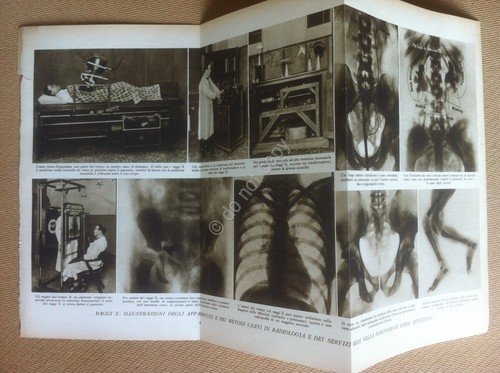 Tavola estratta da Enciclopedia Il Medico in Casa - Raggi …