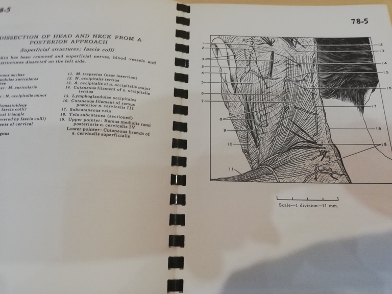 A stereoscopic atlas of human anatomy, D. Bassett, 75 - …