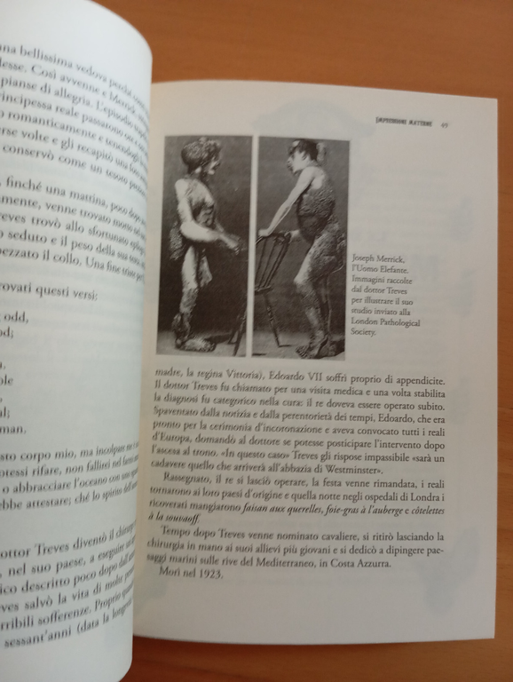 Storia dei freak. Mostri come noi, Omar lopez Mato, Odoyo, …