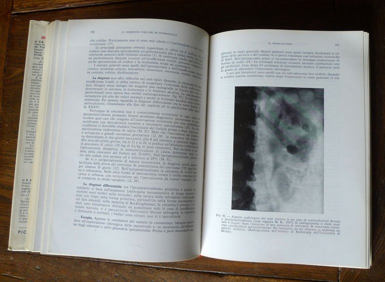 François Reubi,NEFROLOGIA CLINICA,1971 Piccin[manuale,MEDICINA