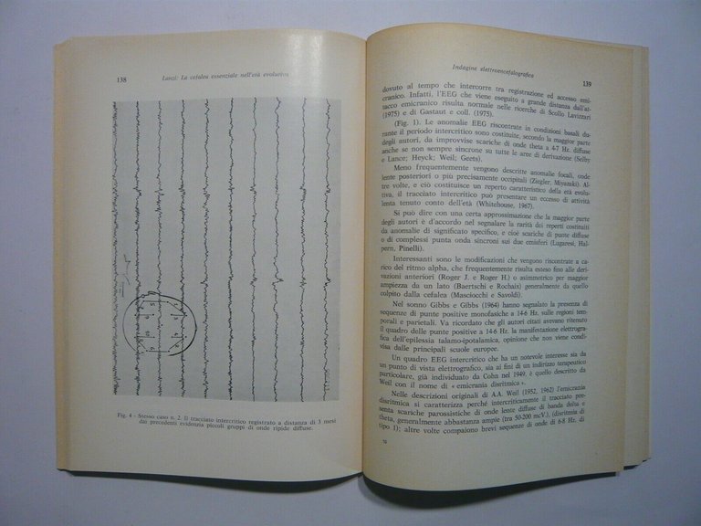Giovanni Lanzi,CEFALEA ESSENZIALE NELL’ETA’ EVOLUTIVA,1980 Pensiero scientifico