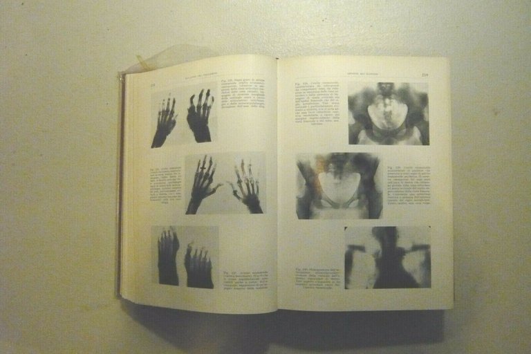 Introzzi,MALATTIE DEL COLLAGENO,DELL'APPARATO LOCOMOTORE,PATOLOGIA ETA' SENILE