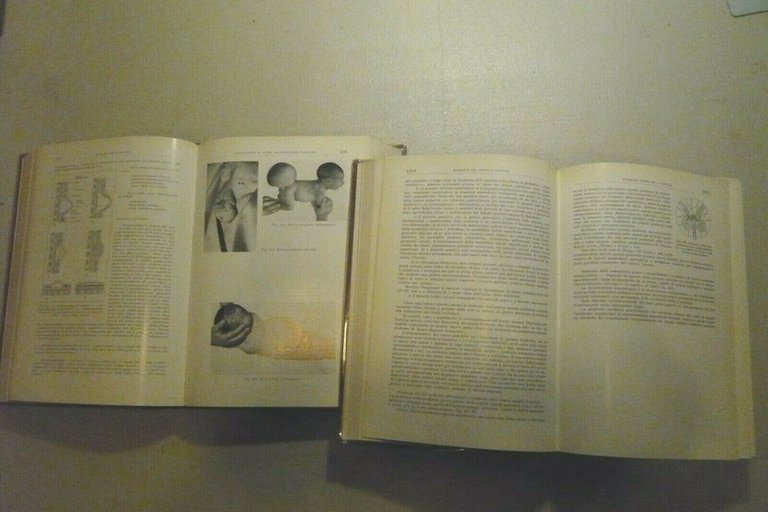 Introzzi,MALATTIE DEL SISTEMA NERVOSO 2 Voll.,1964[Trattato Medicina Interna