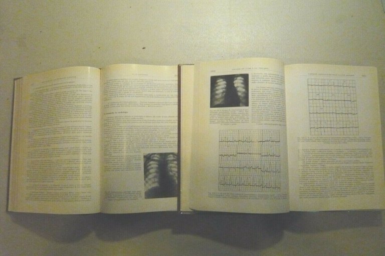 Introzzi,MALATTIE DELL'APPARATO CARDIOVASCOLARE,1965[TRATTATO MEDICINA