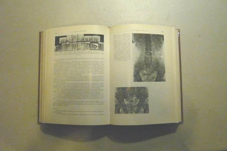 Introzzi,MALATTIE DELLE GHIANDOLE A SECREZIONE INTERNA,1968[Trattato Medicina