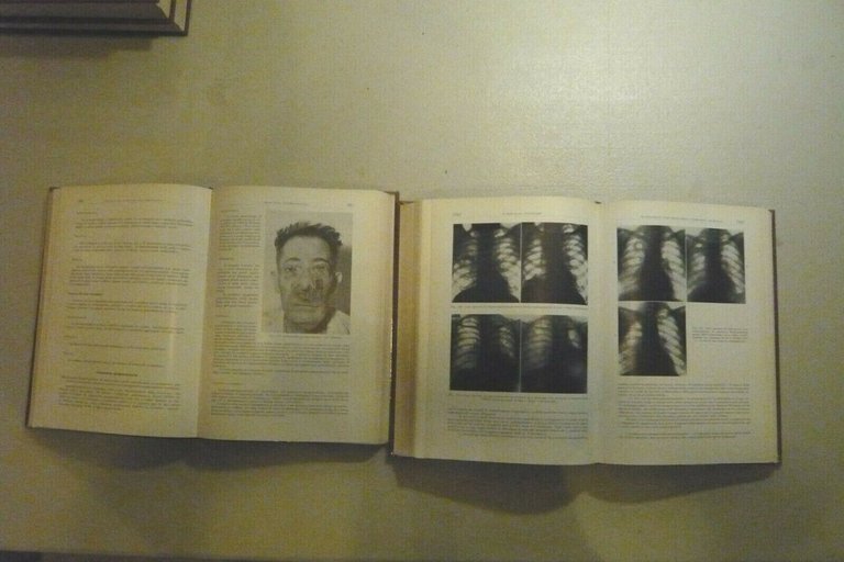 Introzzi, MALLATTIE DELL'APPARATO RESPIRATORIO, DEL MEDIASTINO E DEL DIAFRAMMA