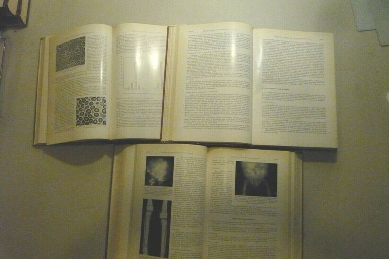 Introzzi,SANGUE ORGANI EMOPOIETICI SISTEMA RETICOLO-ISTIOCITARIO, 1961