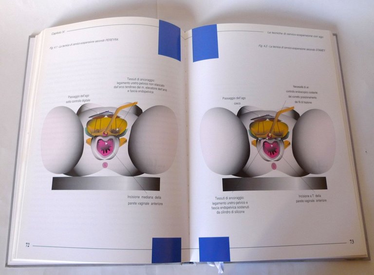 LA CERVICOSOSPENSIONE SECONDO RAZ.ATLANTE ILLUSTRATO,1997[medicina,ginecologia