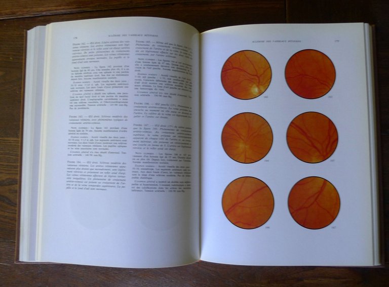 Larsen,MANUEL ET ATLAS DU FOND D'OEIL NORMAL ET PATHOLOGIQUE,1971[OFTALMOLOGIA
