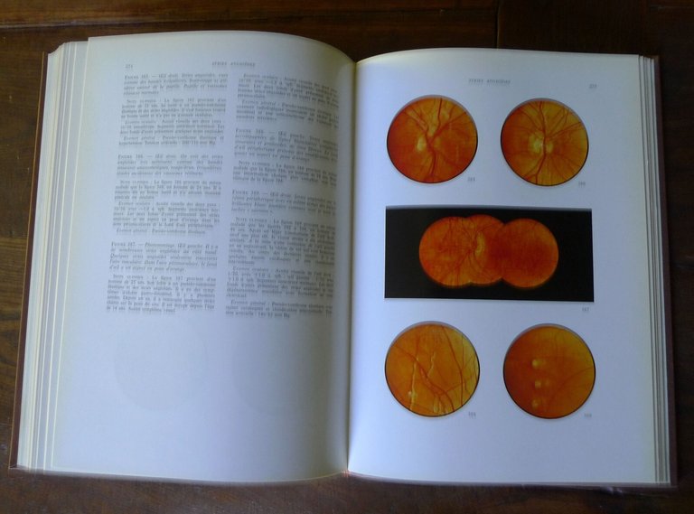Larsen,MANUEL ET ATLAS DU FOND D'OEIL NORMAL ET PATHOLOGIQUE,1971[OFTALMOLOGIA
