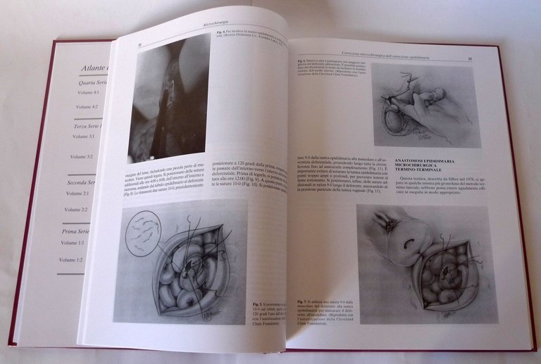 Lipshultz,MICROCHIRURGIA,1997 Verduci[medicina,chirurgia,ATLANTE DI UROLOGIA