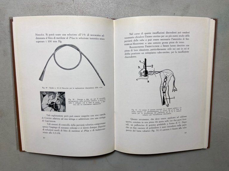 Marchesi,Albano,Cittadini,LE SALPINGOPLASTICHE,Società Editrice Universo 1965 | Immagine Gallery 4