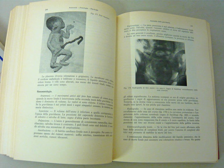 Merger/Levy/Melchior,COMPENDIO DI OSTETRICIA,1972 UTET[manuale,medicina
