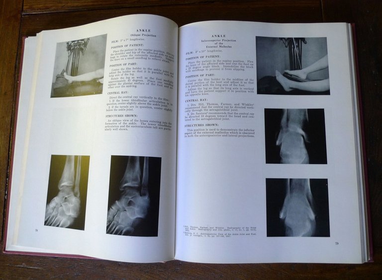 Merrill,ATLAS OF ROENTGENOGRAPHIC POSITIONS.2 voll.,1959 Mosby[radiografia