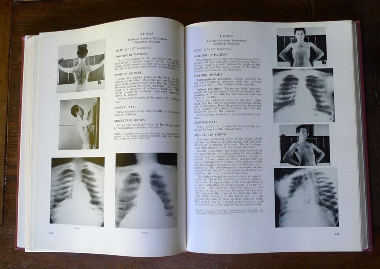 Merrill,ATLAS OF ROENTGENOGRAPHIC POSITIONS.2 voll.,1959 Mosby[radiografia