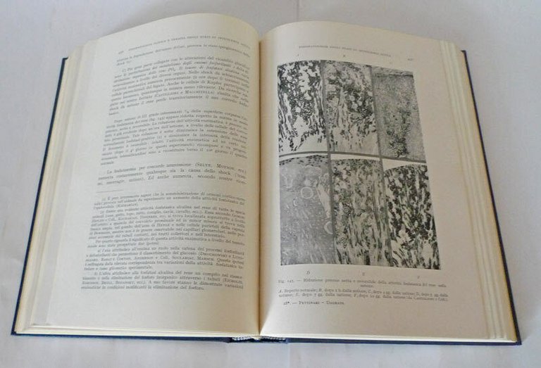 Pettinari,GRANDI SINDROMI DISMETABOLICHE DI INTERESSE CHIRURGICO,1956[medicina