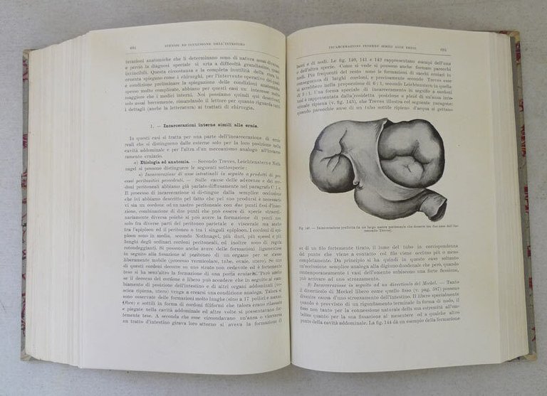 Schmidt,TRATTATO DELLE MALATTIE INTESTINALI,1915[medicina,gastroenterologia