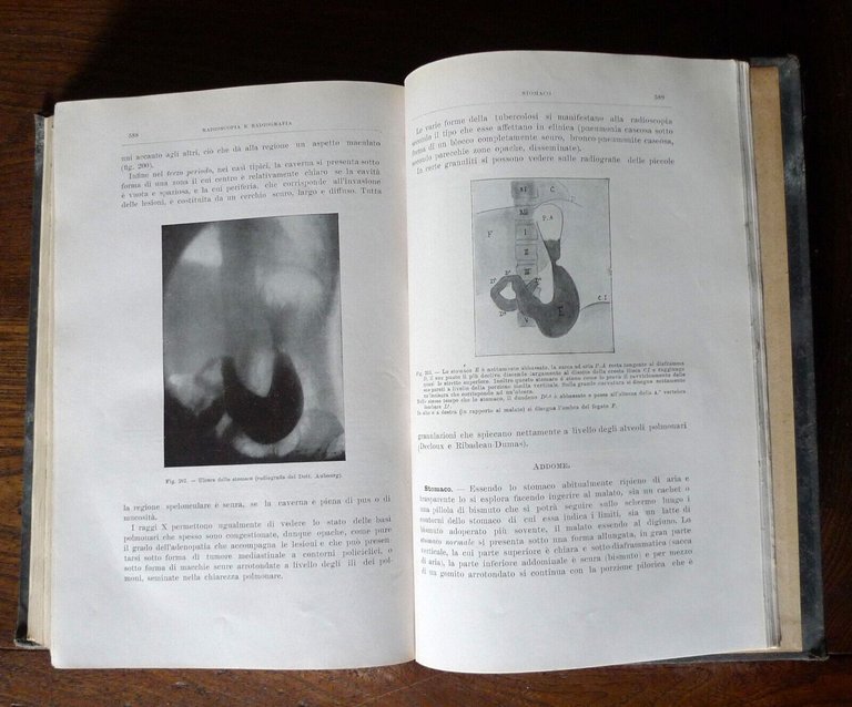 SERGENT,TECNICA DI CLINICA MEDICA E SEMIOLOGIA,1916 Soc.Ed.Libraria[MEDICINA