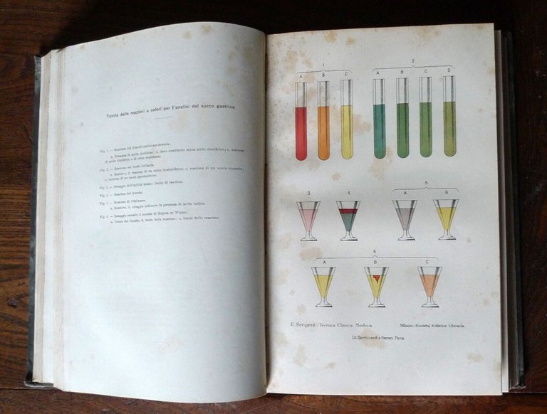 SERGENT,TECNICA DI CLINICA MEDICA E SEMIOLOGIA,1916 Soc.Ed.Libraria[MEDICINA