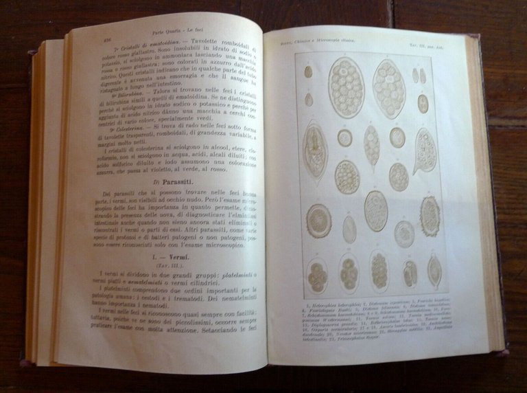 Sisto,MICROSCOPIA E CHIMICA CLINICA,1929 UTET[STORIA MEDICINA