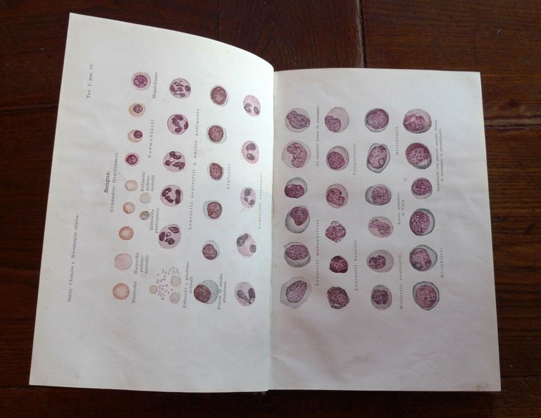 Sisto,MICROSCOPIA E CHIMICA CLINICA,1929 UTET[STORIA MEDICINA