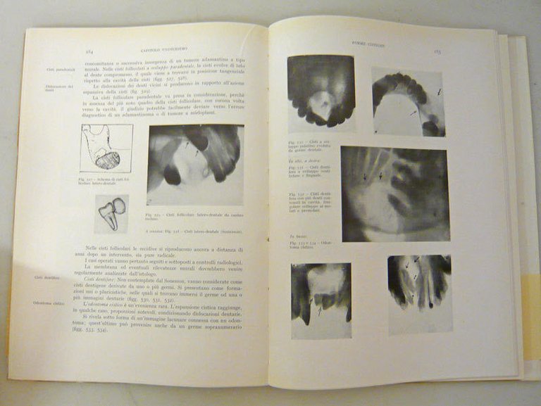 Smerchinich,DIAGNOSTICA RADIOLOGICA E TERAPIA FISICA IN ODONTOIATRIA,1954 Hoepli