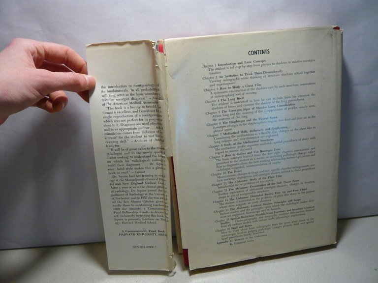 Squire, FUNDAMENTALS OF ROENTGENOLOGY,1974[radiologia