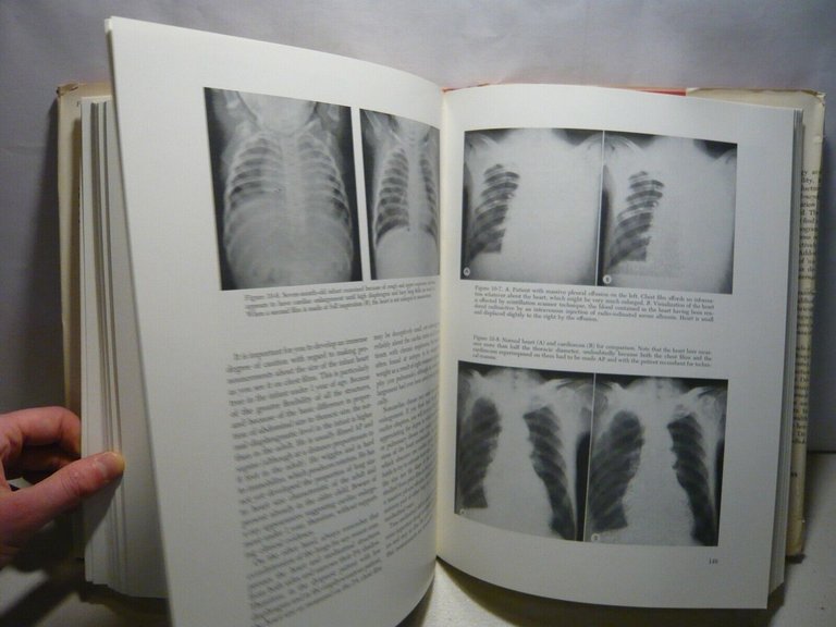 Squire, FUNDAMENTALS OF ROENTGENOLOGY,1974[radiologia