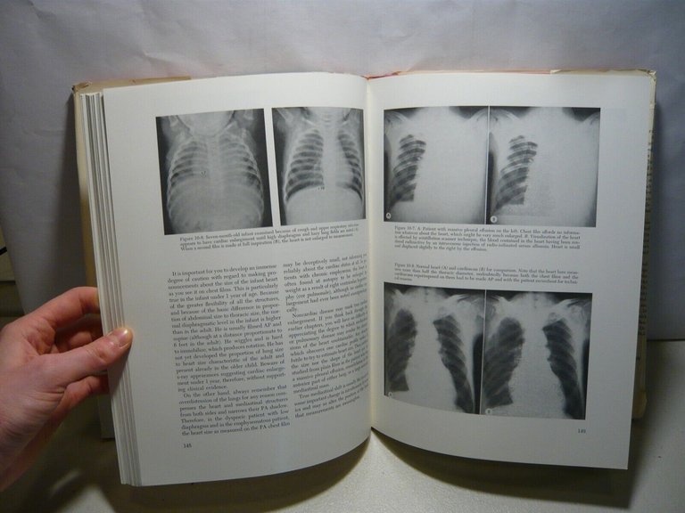 Squire, FUNDAMENTALS OF ROENTGENOLOGY,1974[radiologia