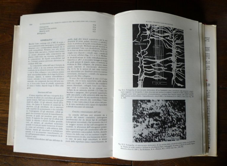 Thompson/Wootton,PATOLOGIA BIOCHIMICA,1972 Piccin[manuale,MEDICINA